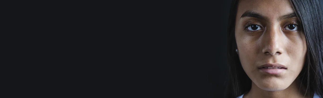 Pigmentation Treatment in Delhi