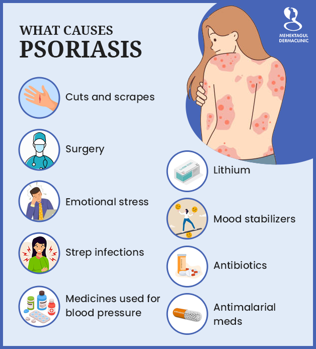   Psoriasis treatment in Delhi: Plagues, scales, and crusts are common symptoms of psoriasis. They are red with different-coloured scales and can be itchy and painful.