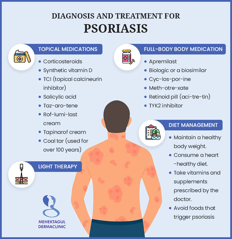 psoriasis treatment in Delhi: The psoriasis treatment options including Topical Medications, Light Therapy, Full-body Body Medication, and Diet Management.