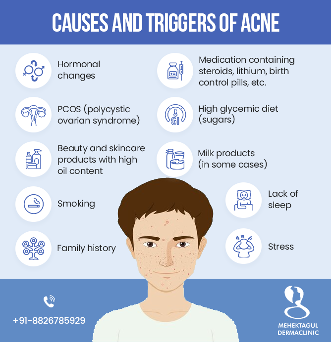 Acne treatment in Delhi: Hormonal changes, PCOS (polycystic ovarian syndrome), Lack of sleep, Smoking, Stress, and Family history is the Causes and Triggers of Acne