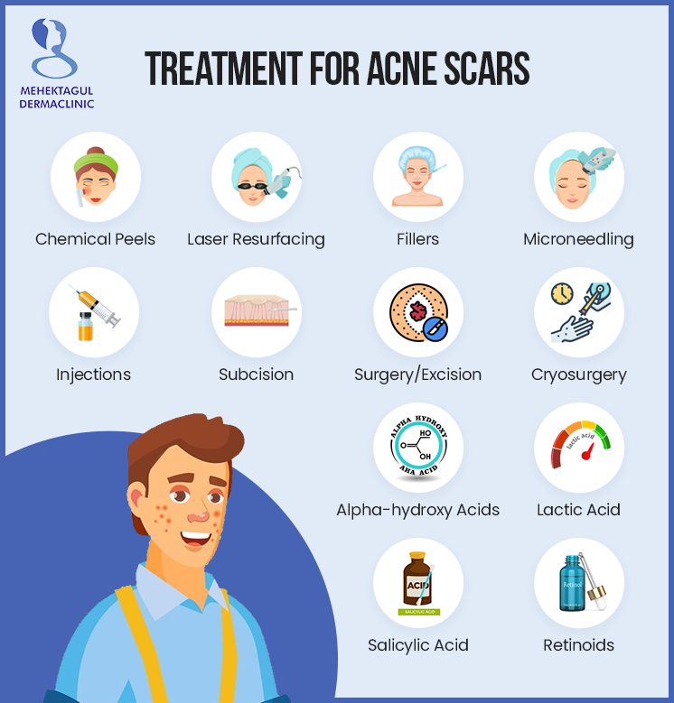 Best acne scar treatment in Delhi: Treatment for acne scars from mehektagul dermaclinic